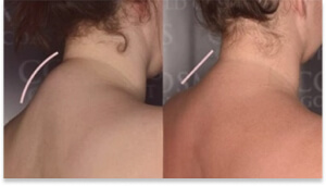 előzd meg a mozgásszervi problémákat